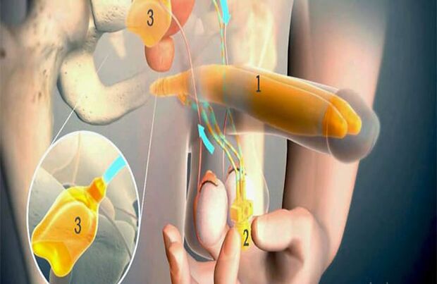 Lipofilling operazioa
